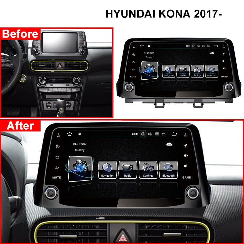 9“ Android 10 for Hyundai Encino Kona 2017 2018 2019 Car Multimedia Stereo Player No DVD Car Radio GPS Navigation Carplay Head Unit