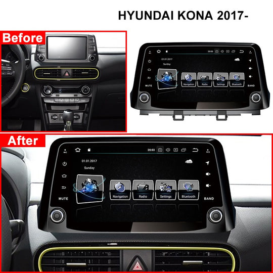 9“ Android 10 for Hyundai Encino Kona 2017 2018 2019 Car Multimedia Stereo Player No DVD Car Radio GPS Navigation Carplay Head Unit